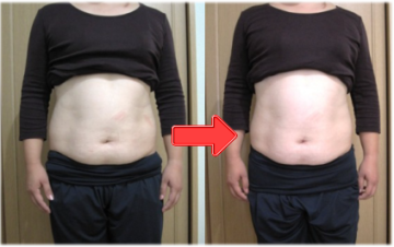 チネイザン効果