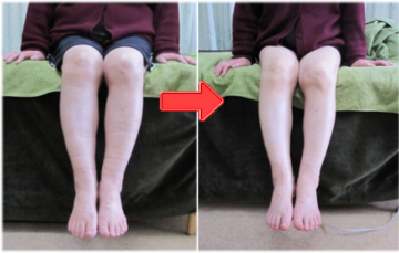 むくみ　脚　スッキリ