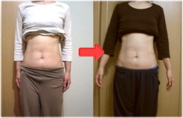 チネイザンビフォーアフタ