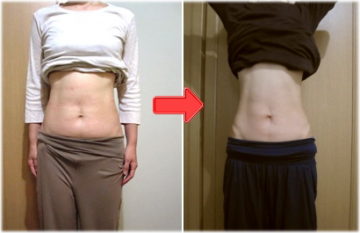 チネイザンビフォーアフター